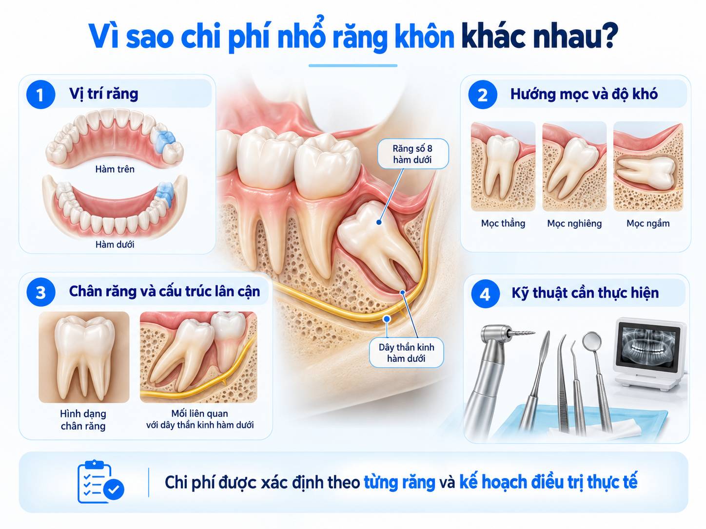 Các yếu tố ảnh hưởng đến chi phí nhổ răng khôn gồm vị trí răng, hướng mọc, chân răng và kỹ thuật thực hiện